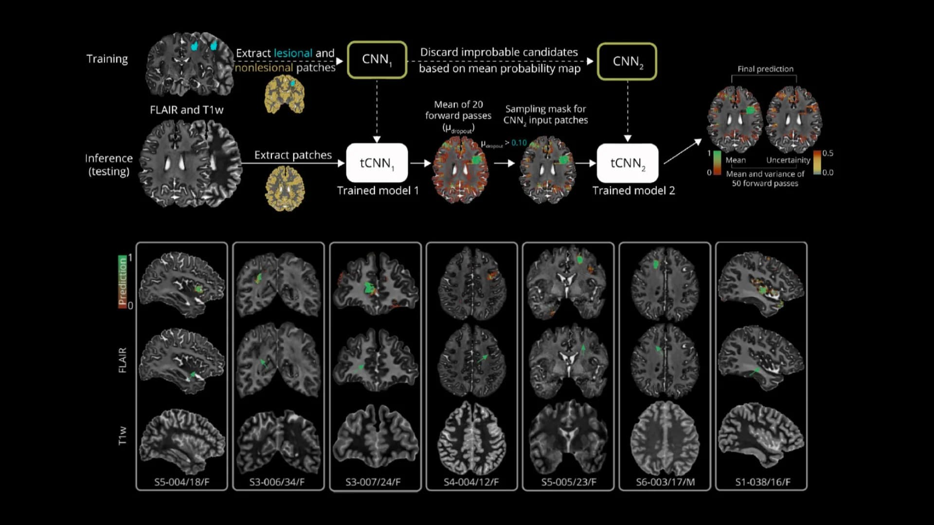 MRI processing pipeline