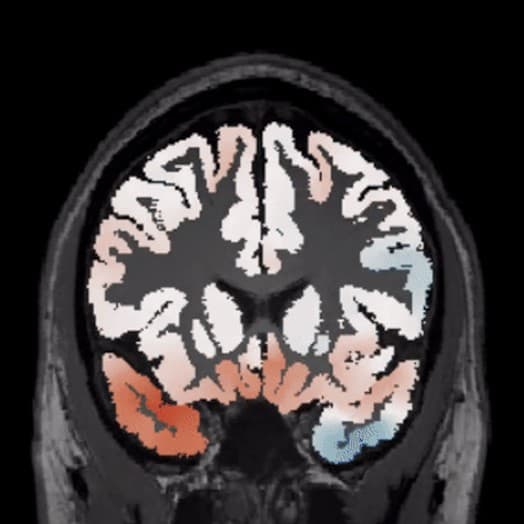 AI DIAGNOSTICS